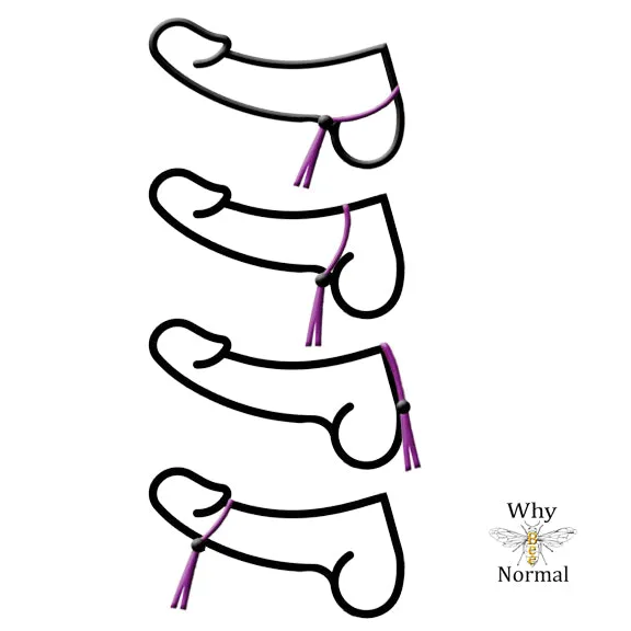 Pearl Penis Chain, Penis Noose with Pearl